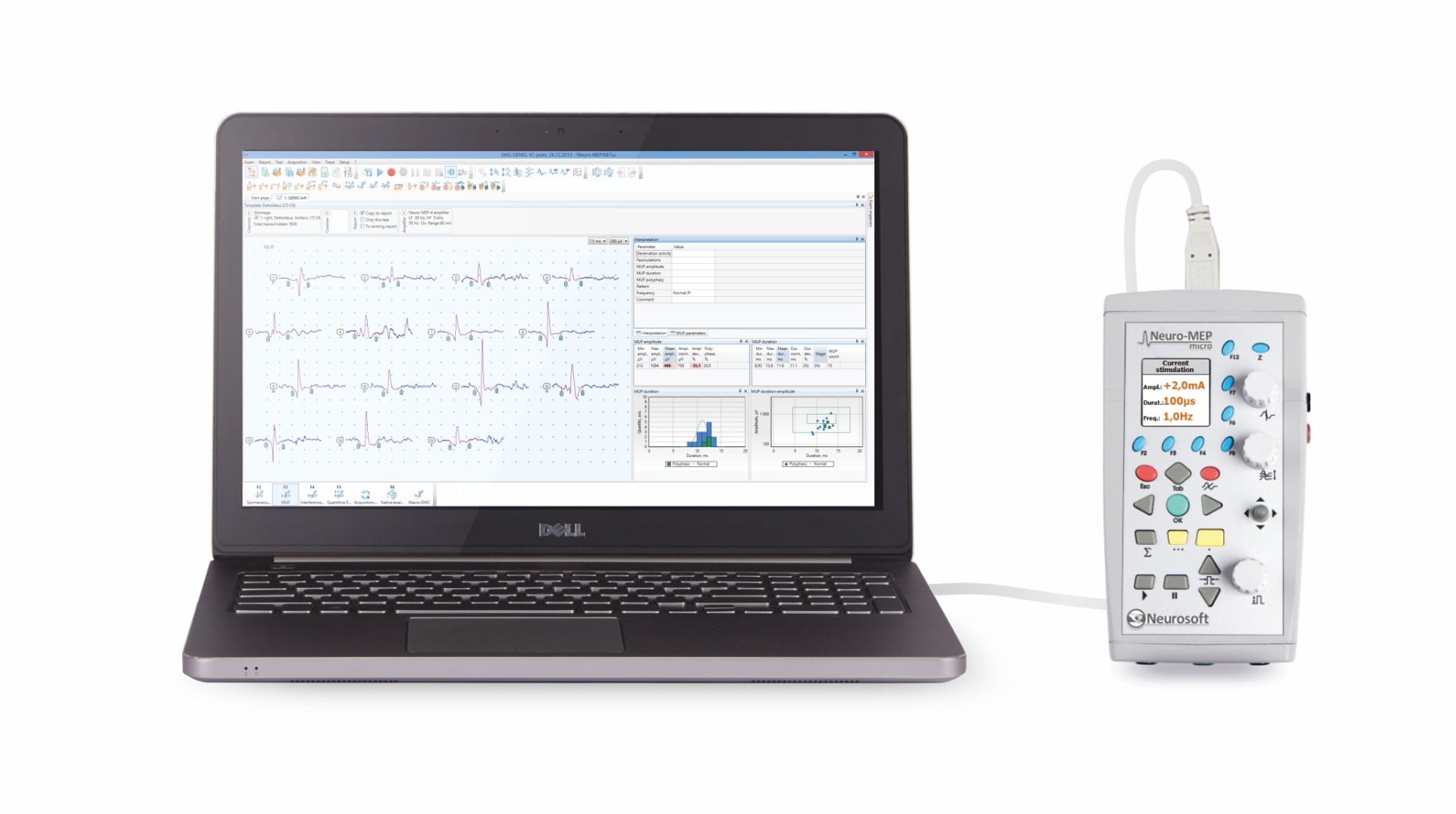 neuromep micro neuromed emg 1