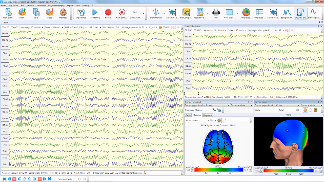 neuron spectrum 1