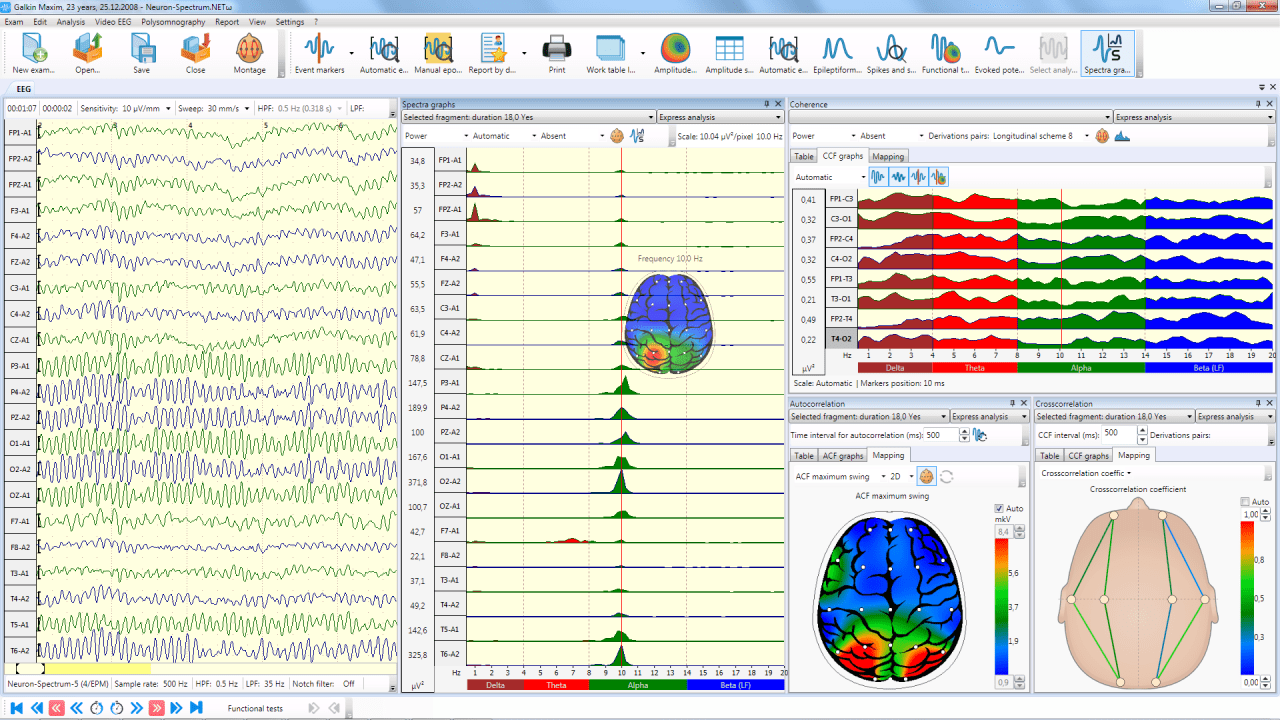 neuron spectrum 1