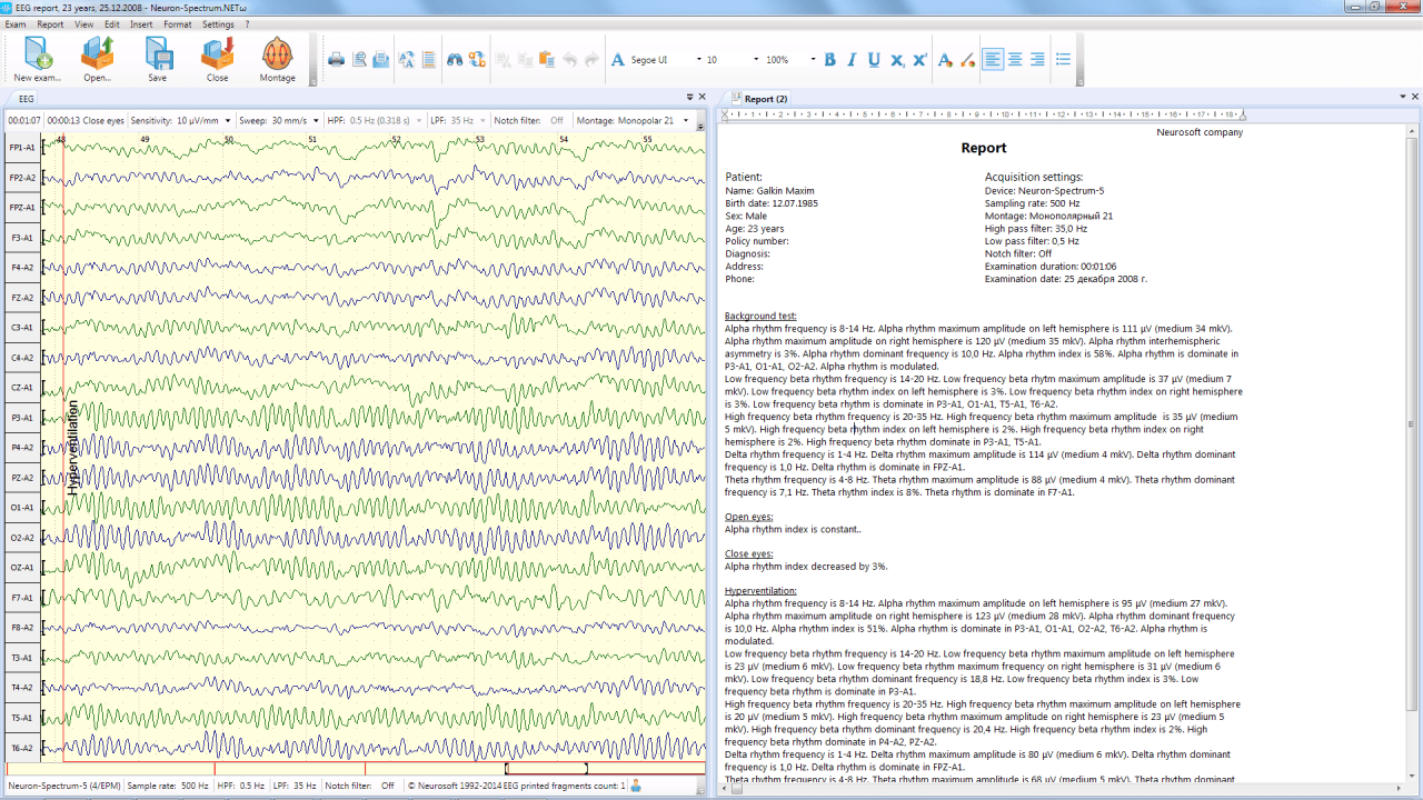 neuron spectrum 1