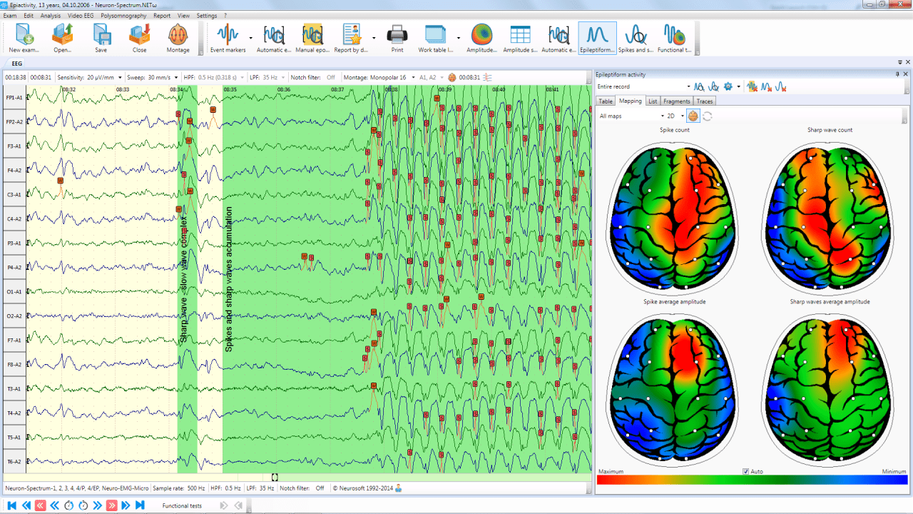 neuron spectrum 1