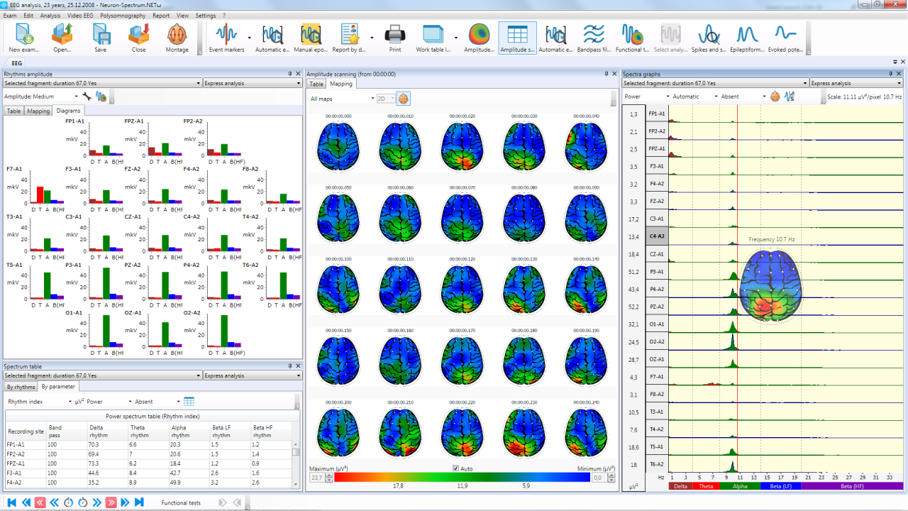 neuron spectrum 1